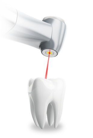 dental-laser-dental-2